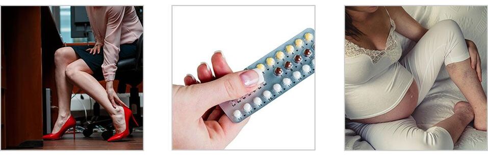 Ursachen für Krampfadern in den Beinen